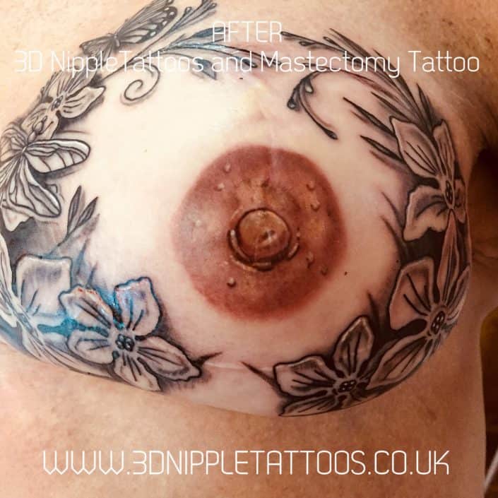 1BD19C2F-3E7F-4412-9D3C-6A72CE4B78CF Mastectomy Tattoo By Helen Aldous, Yorkshire UK